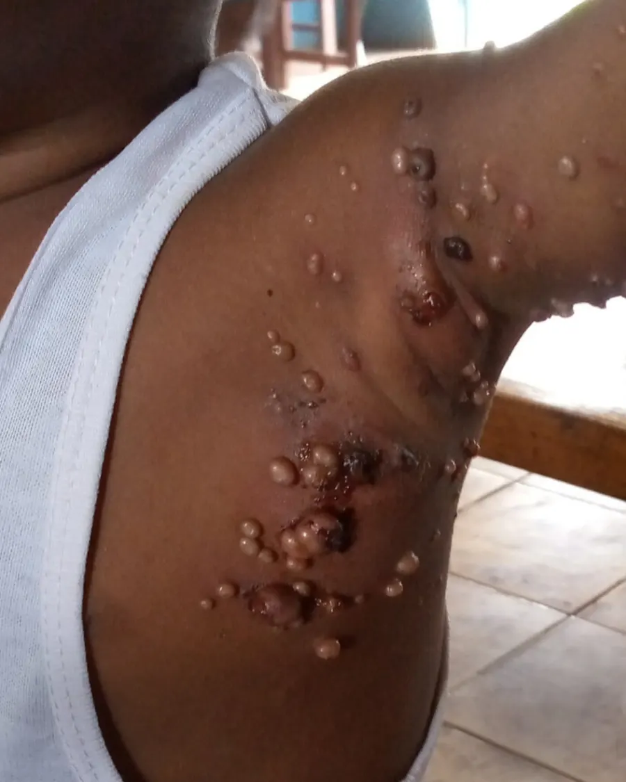 Expert Pediatric Dermatology Care at Cinch Clinics
